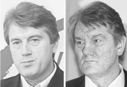 Viktor Yushchenko photographed in March 2002, left, and December 2004, right. Toxicological analysis found the mysterious illness that scarred his face was caused by dioxin poisoning. AP/Wide World Photos.